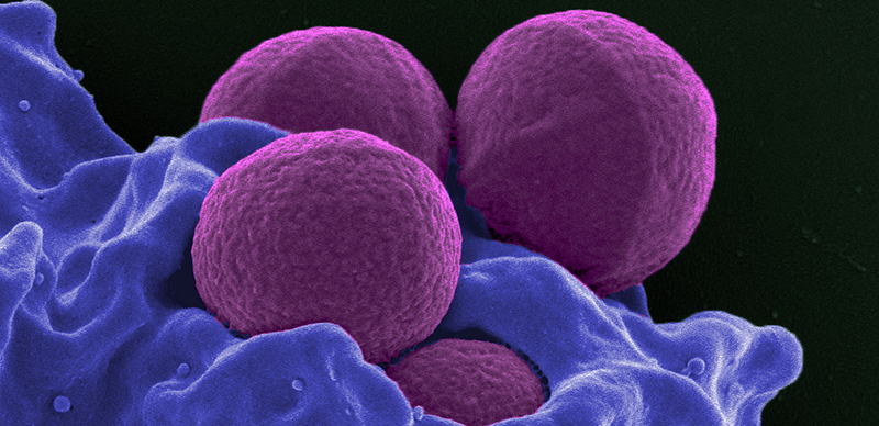 Экспериментальный антибиотик уничтожил супербактерию Ученые считают, что это важный шаг в борьбе с антибактериальной устойчивостью A1b1a89e5b19a10b97d35e1d96411e8a